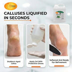 SPA REDI - Callus Remover for Feet Gel, Mint and Eucalyptus, 128 Oz - - Image 2