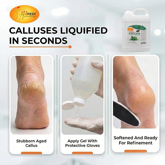 SPA REDI - Callus Remover for Feet Gel, Mint and Eucalyptus, 128 Oz - - Image 2