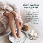 DeEnti Double Pumice Pack, Bundle Includes Mint Scented Callus Remover - Image 3