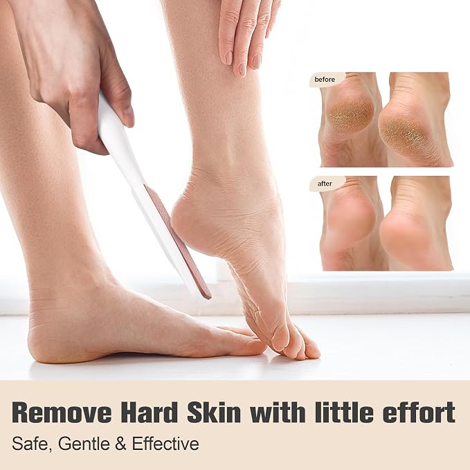 FERYES Glass Foot File Callus Remover - Image 2