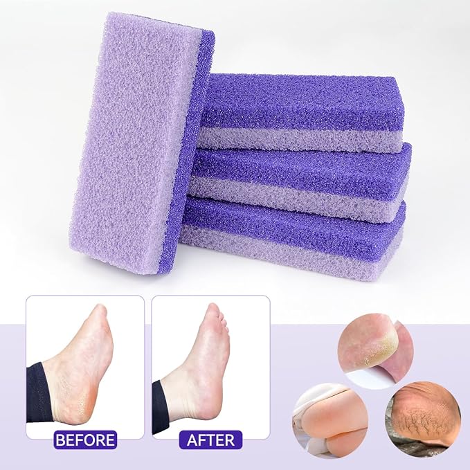 4 Pcs Foot Pumice Stone and Scrubber - Image 5