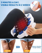 ONUEMP Cellulite Massage Tool, Lymphatic Drainage Cellulite Remover - Image 3