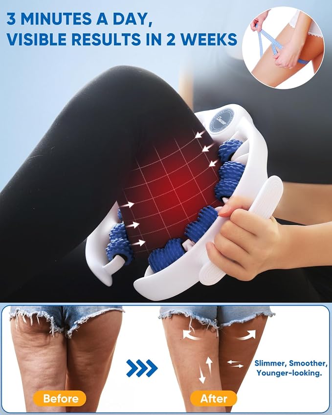 ONUEMP Cellulite Massage Tool, Lymphatic Drainage Cellulite Remover - Image 3