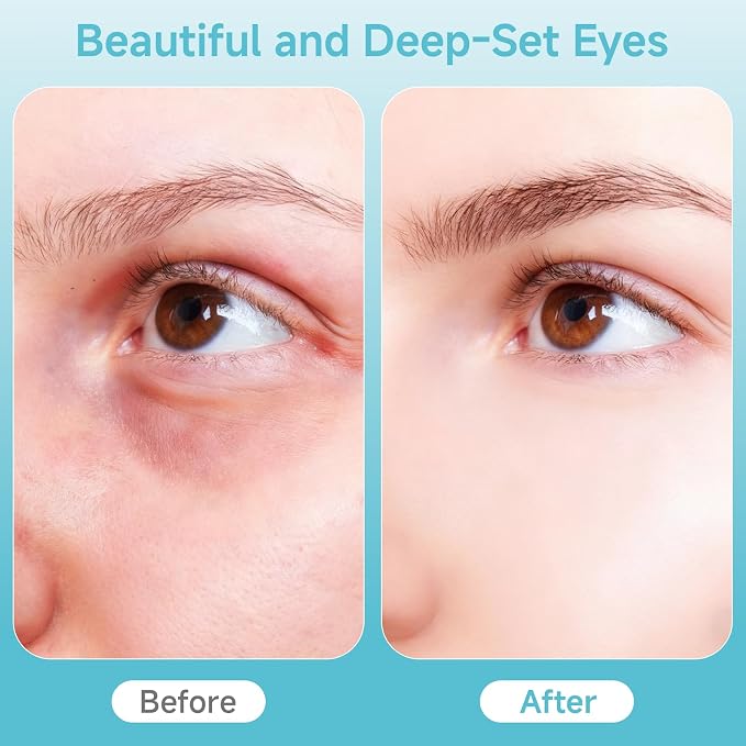 Depuffing Wand for Face & Eyes – 2-in-1 Cold and Heat Facial Therapy - Image 6