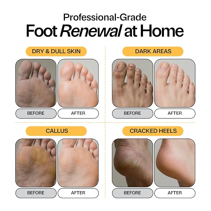 Skin Brightening Foot Soak - Image 3