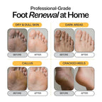 Skin Brightening Foot Soak - Image 3