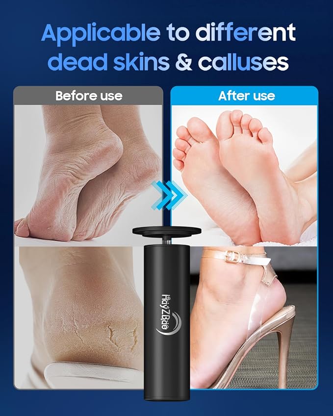 HayZBao Electric Foot Callus Remover - Image 5