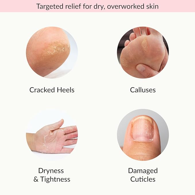 Epielle Moisturizing Hand & Foot Masks, Soften Dry Skin - Image 4