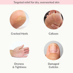 Epielle Moisturizing Hand & Foot Masks, Soften Dry Skin - Image 4