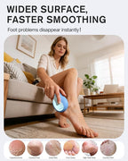 BEZOX Glass Foot File Callus Remover – Professional Foot Scrubber - Image 2
