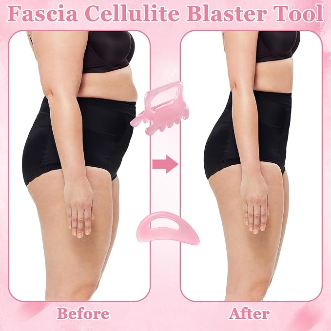 ProSuites 2Pack Fascia Massage Tool, Fascia Blaster - Image 6