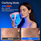 INIA Glow 4D Wireless Red Light Therapy Mask - Image 5