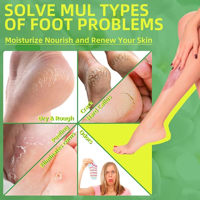 Foot Exfoliating Scrub, Sugar Scrub, Dead Skin Remover - Image 2
