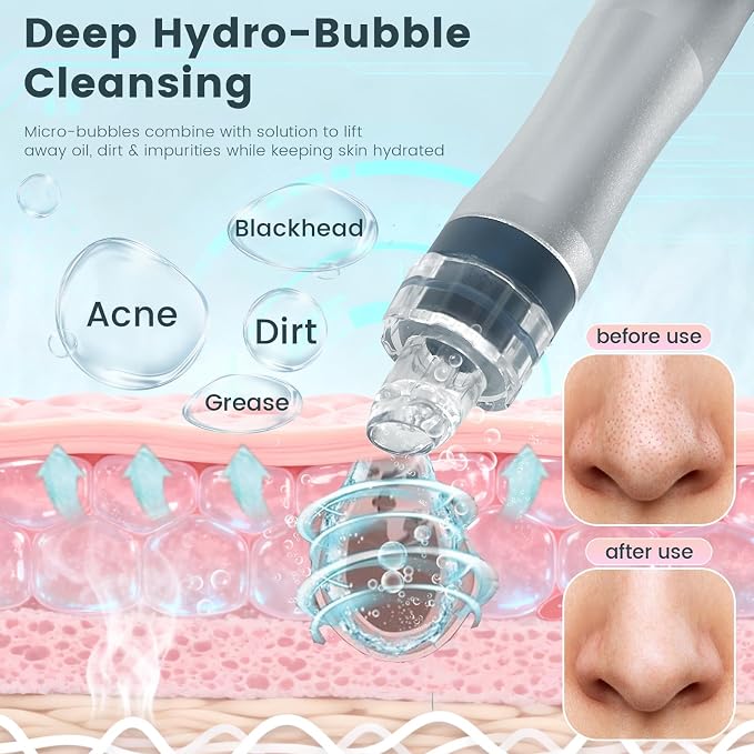 Hydrogen Oxygen Facial Machine, Hydro Facial Machine & Hydrodermabrasion Machine - Image 2