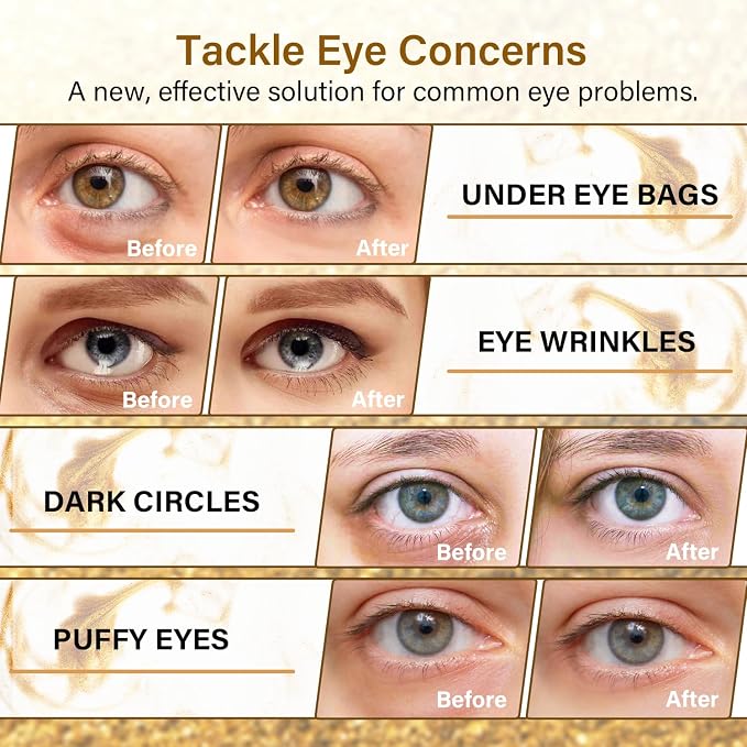 Gold Cucumber Under Eye Patches - Image 3