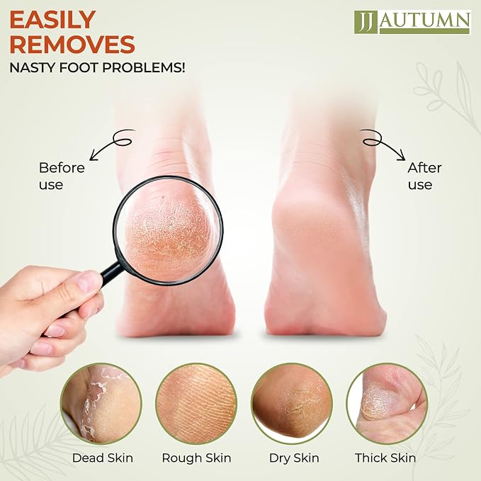 Spa Quality Foot Rasp/Callus Remover Double Sided Wood Professional Foot File - Image 3