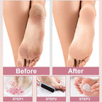 36 Pieces Flat Shaped Foot File Foot Callus Remover - Image 3