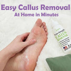 Callus Remover for Feet Foot Callus Remover Gel, Spa Foot Care, Pedicure Tools - Image 5