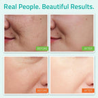 YEOUTH Skin Care Set | Hyaluronic Acid Serum - Image 3
