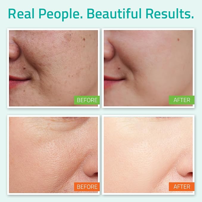 YEOUTH Skin Care Set | Hyaluronic Acid Serum - Image 3