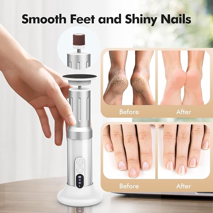 Electric Foot Callus Remover Cordless Electric Foot Filer Kit - Image 6