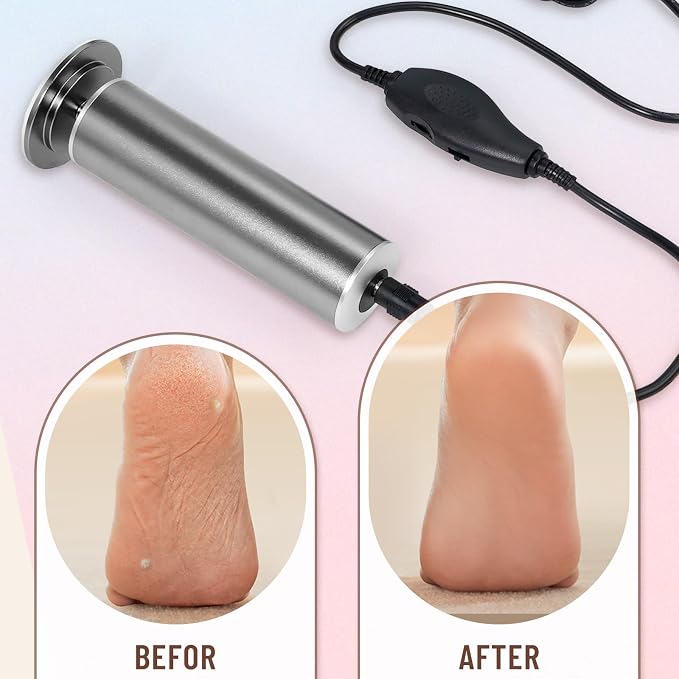 Dermawave Electric Foot File Callus Remover - Image 2