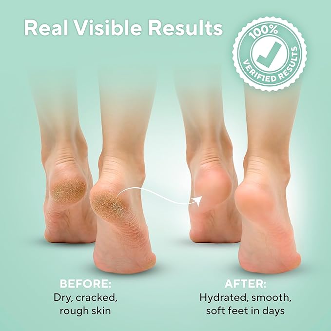 Tea Tree Oil Foot Soak and 40% Urea Cream - Image 5
