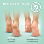 Tea Tree Oil Foot Soak and 40% Urea Cream - Image 5