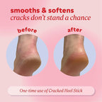 Onyx Professional Cracked Heel Repair Balm Stick - Image 4