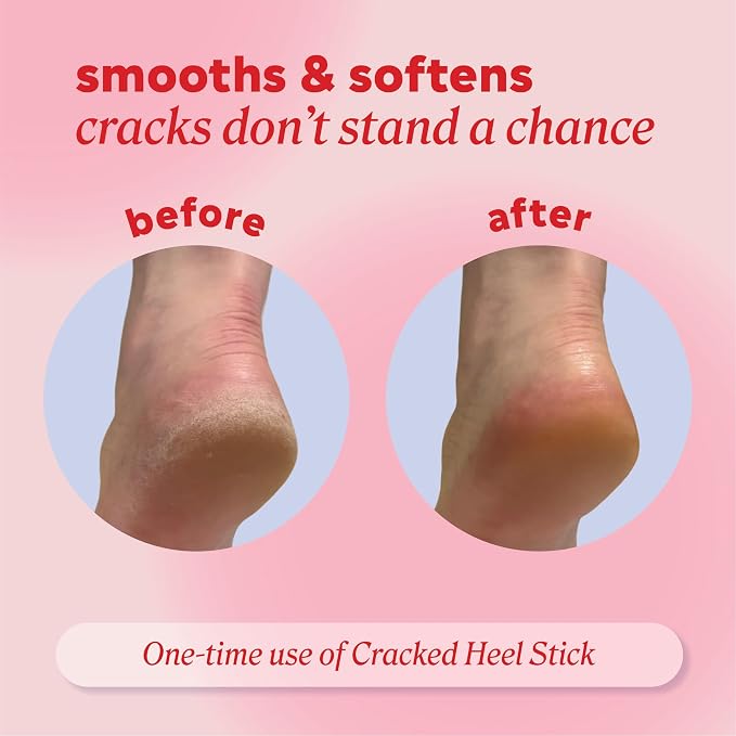 Onyx Professional Cracked Heel Repair Balm Stick - Image 4