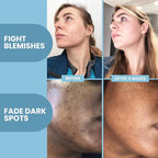 Vitamin C Serum for Face with Retinol & Salicylic 0.83% + Hyaluronic | Skin - Image 5