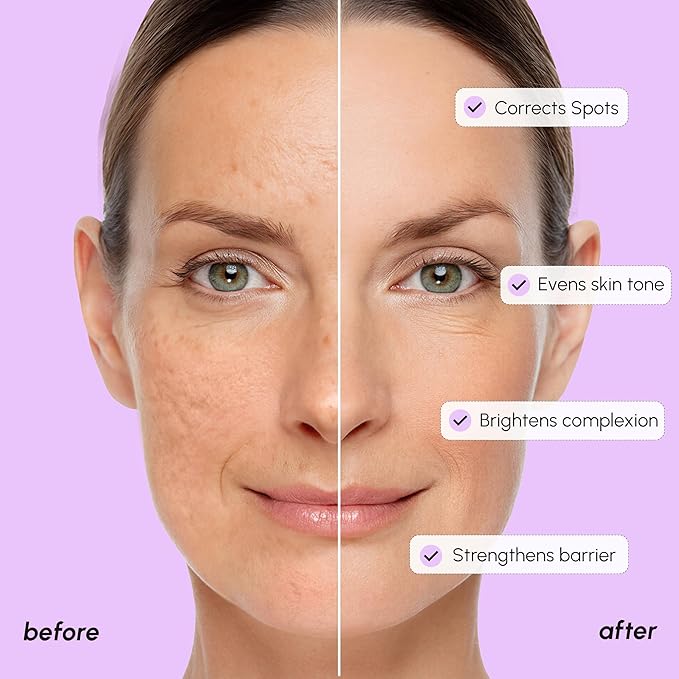MAREE 20% Tranexamic Acid Serum Complex - Image 4