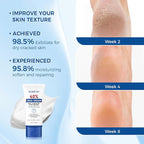 OUKEYA Urea Cream 40 Percent Tube, Urea Cream 40 Percent - Image 6