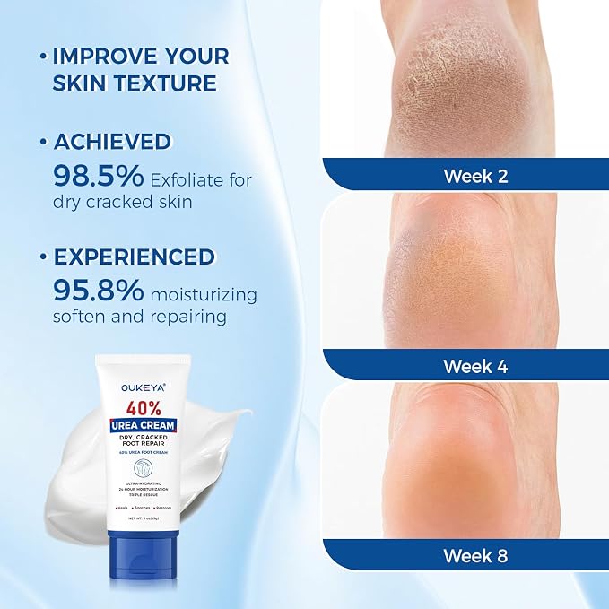 OUKEYA Urea Cream 40 Percent Tube, Urea Cream 40 Percent - Image 6