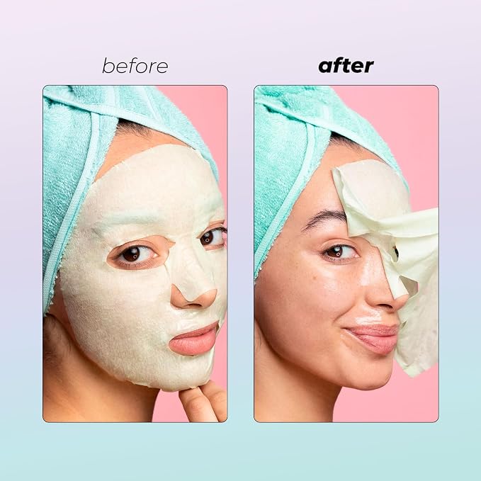 Vitamasques Face Masks Skincare Sheet Kit, Brightening, and Hydrating - Image 3