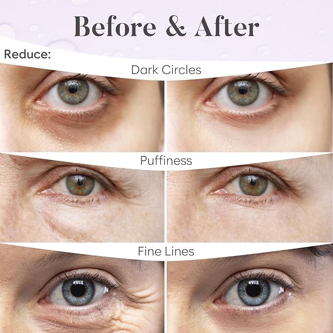 AURAE Retinol & Collagen Under Eye Patches - Image 4