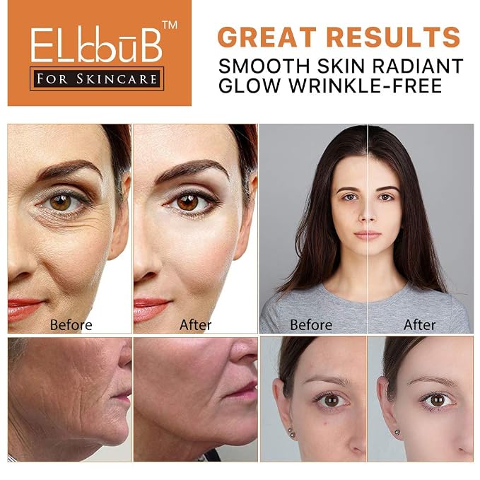 Premium 20% Vitamin C Serum For Face - Image 8