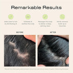 Jupiter Scalp Exfoliator - Image 2
