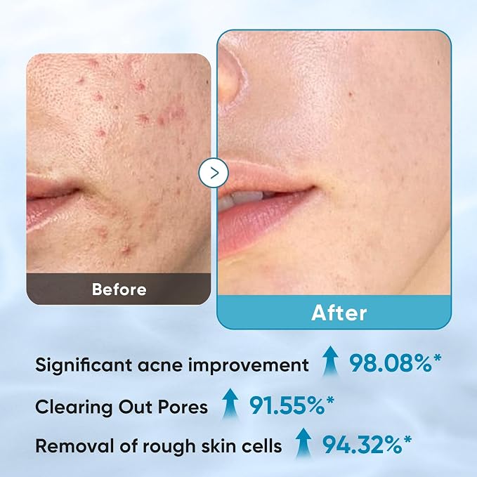 Elvira Glycolic Acid Exfoliating Facial Pads - Image 3
