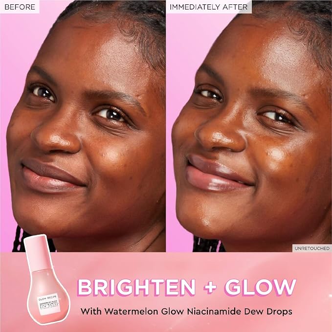 Glow Recipe Watermelon Niacinamide Dew Drops, Korean Niacinamide Serum Drops - Image 4