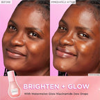 Glow Recipe Watermelon Niacinamide Dew Drops, Korean Niacinamide Serum Drops - Image 4