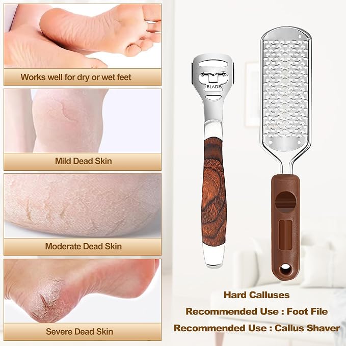 53pcs Foot File Callus Remover, Stainless Steel Large Foot Rasp Foot Scrubber & - Image 5