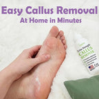 Dr. Entre's Callus Remover Gel: Extra Strength Callus Remover - Image 5