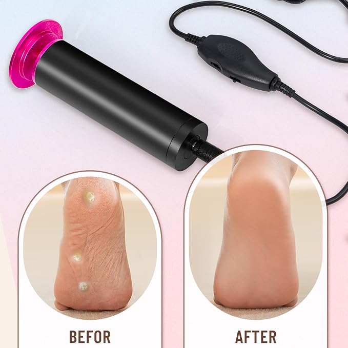 Dermawave Electric Foot File Callus Remover - Image 7