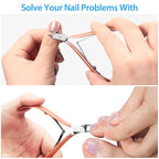 Mudder 3 Pack Rose Gold Cuticle Trimmer Nippers Cutter Tool Stainless Steel - Image 2