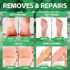 Pedicure Foot Soak, Foot Spa Soak, Pedicure Kit, Bubble Foot Bath - Image 2
