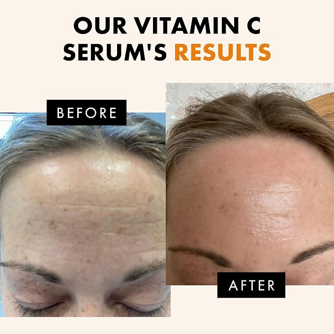 Eclat Skincare Vitamin C Serum - Image 4