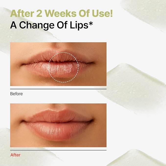 Dr.Different Retinal Lip Balm Clear, Anti-Wrinkle Lip Treatment - Image 3