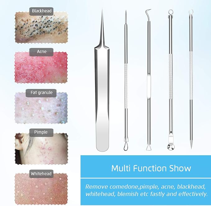 Best Blackhead Remover, Acne Whitehead Removal Kit, Pimple Comedone Extractor - Image 2