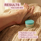 Kerasal Intensive Foot Repair Cream - Image 4
